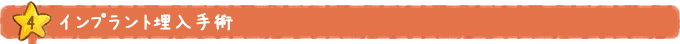 インプラント埋入手術