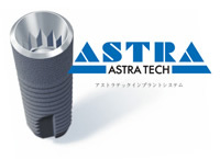 アストラテックインプラント